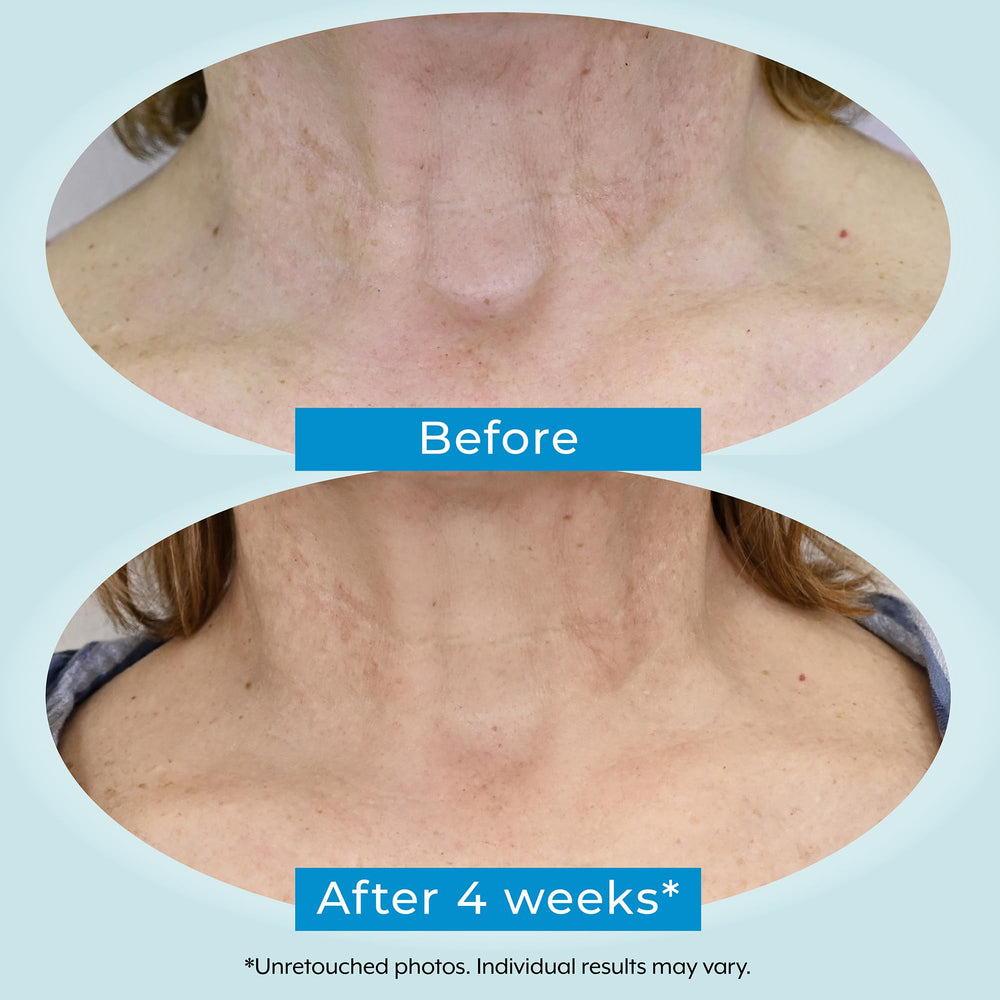 Plexaderm texture swatch reveals lightweight formula for easy absorption.