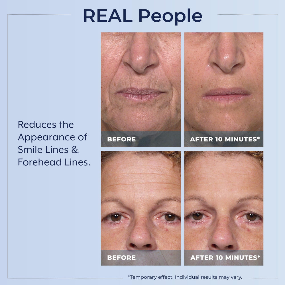 Plexaderm Rapid Reduction Eye Serum around the eye area delivering quick tightening.