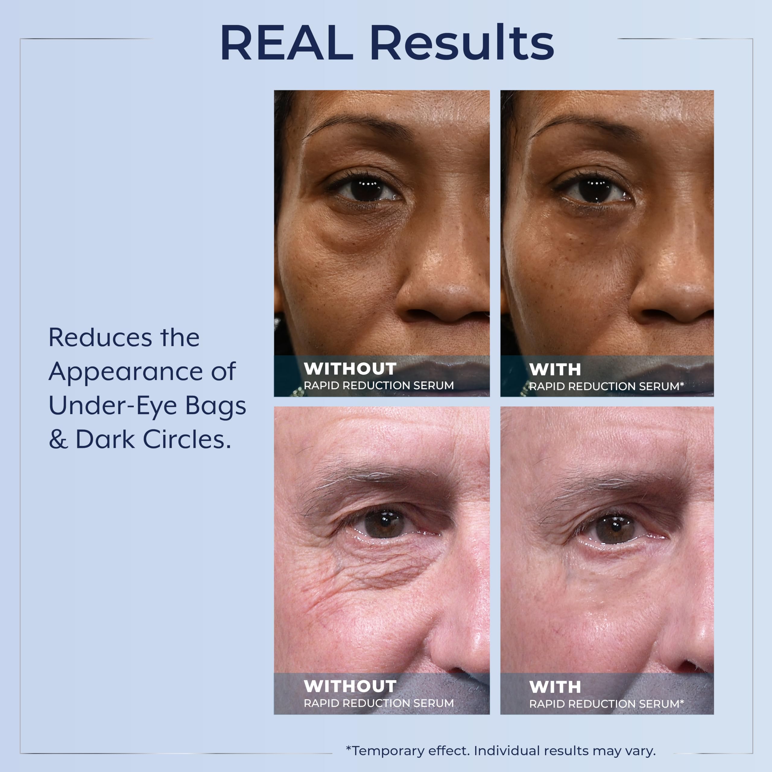 Plexaderm Rapid Reduction Eye Serum clear application on skin for makeup-friendly wear.