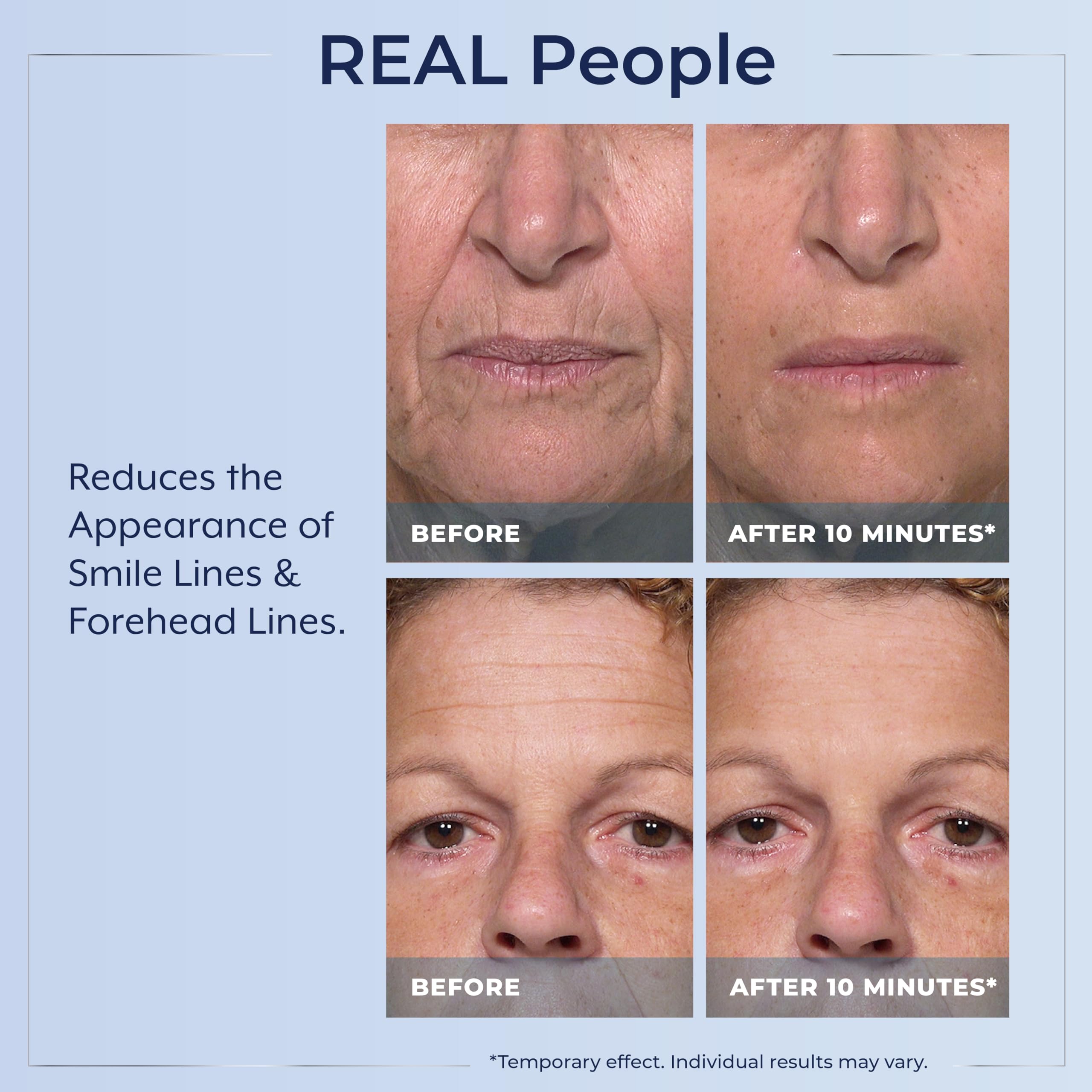 Plexaderm Rapid Reduction Eye Serum pod-pack shows single-use pods for on-the-go skin refresh
