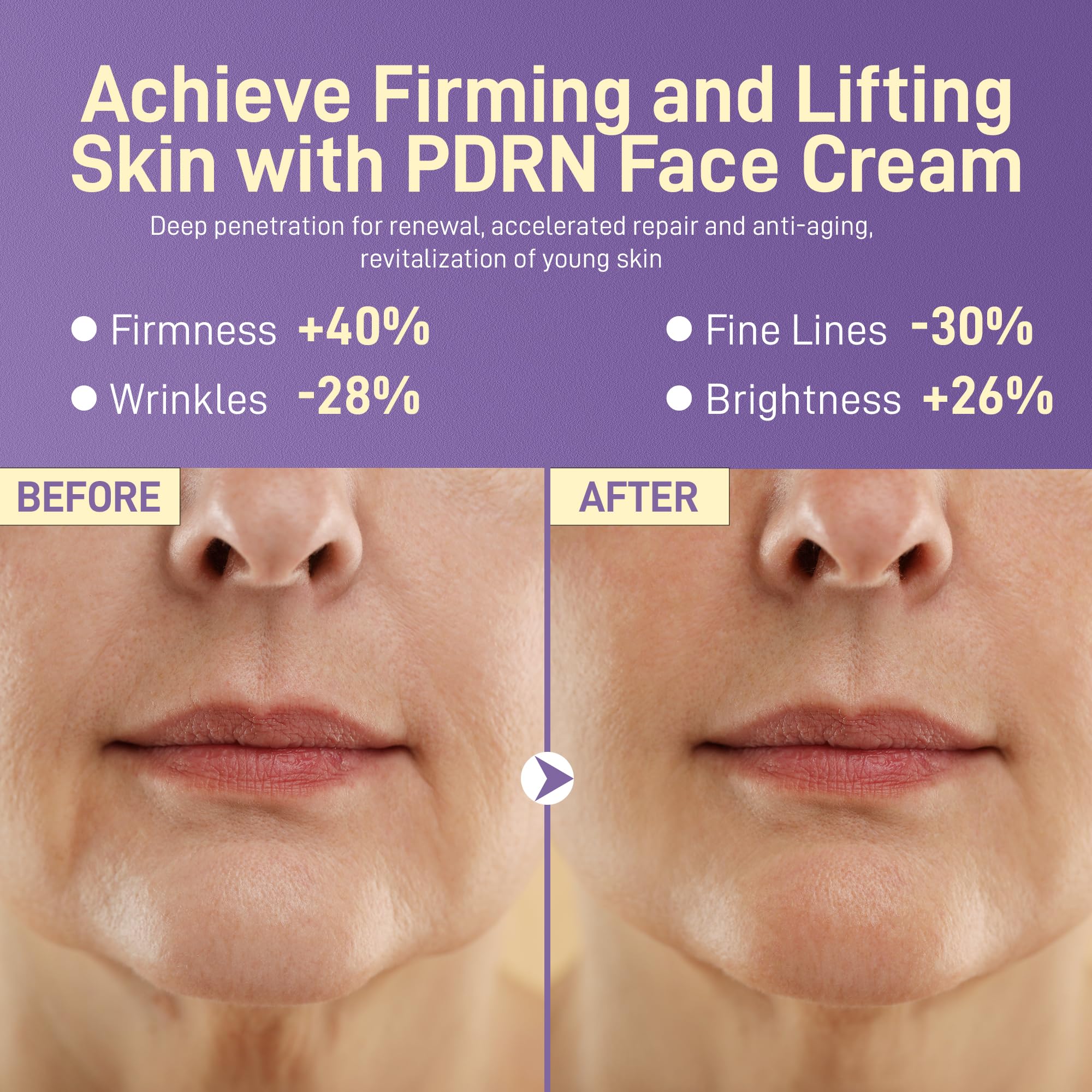 Plus1Herolabs PDRN cream ingredients panel highlighting PDRN and squalane.
