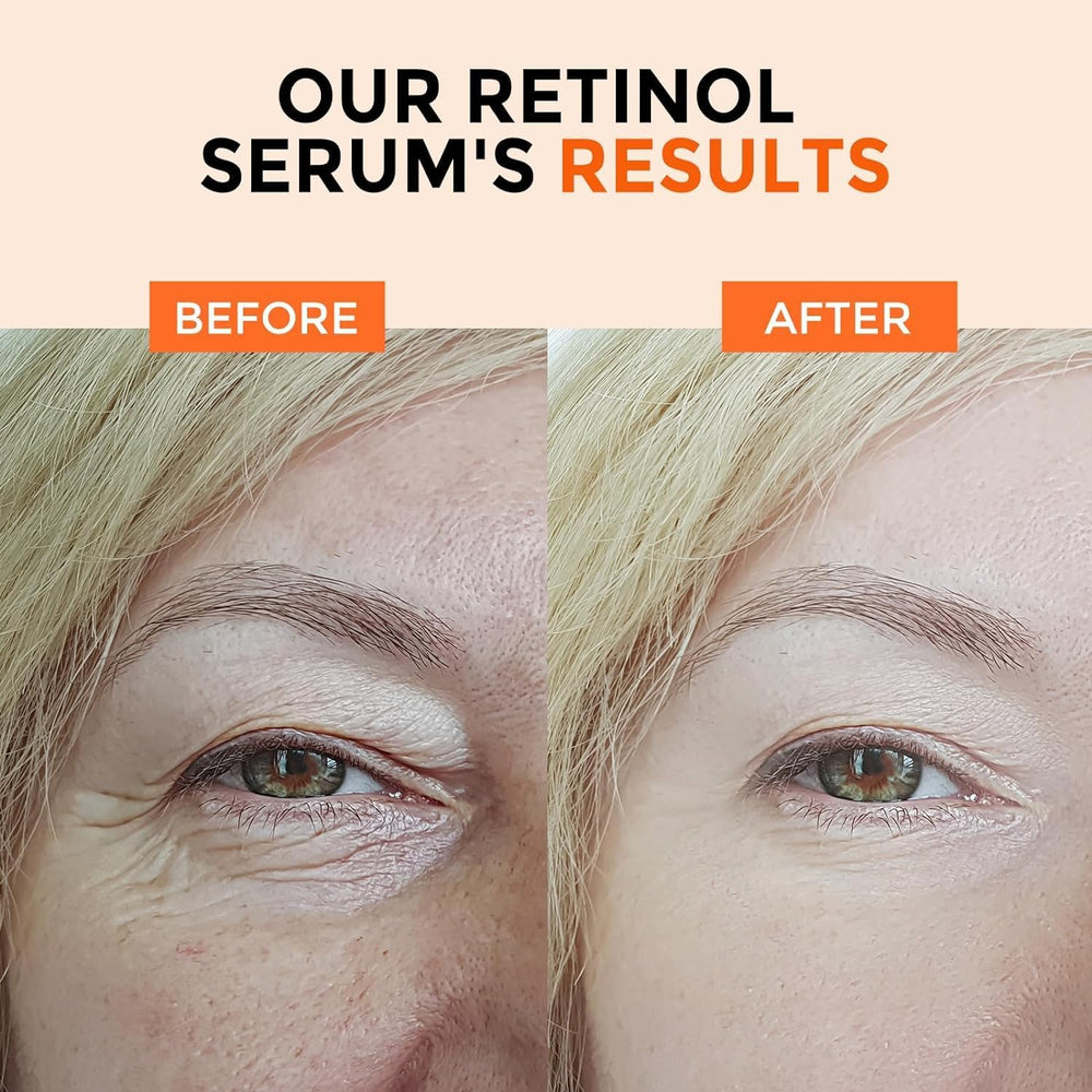 Plus1HEROLABS retinol serum ingredient focus with hyaluronic acid for lasting hydration.