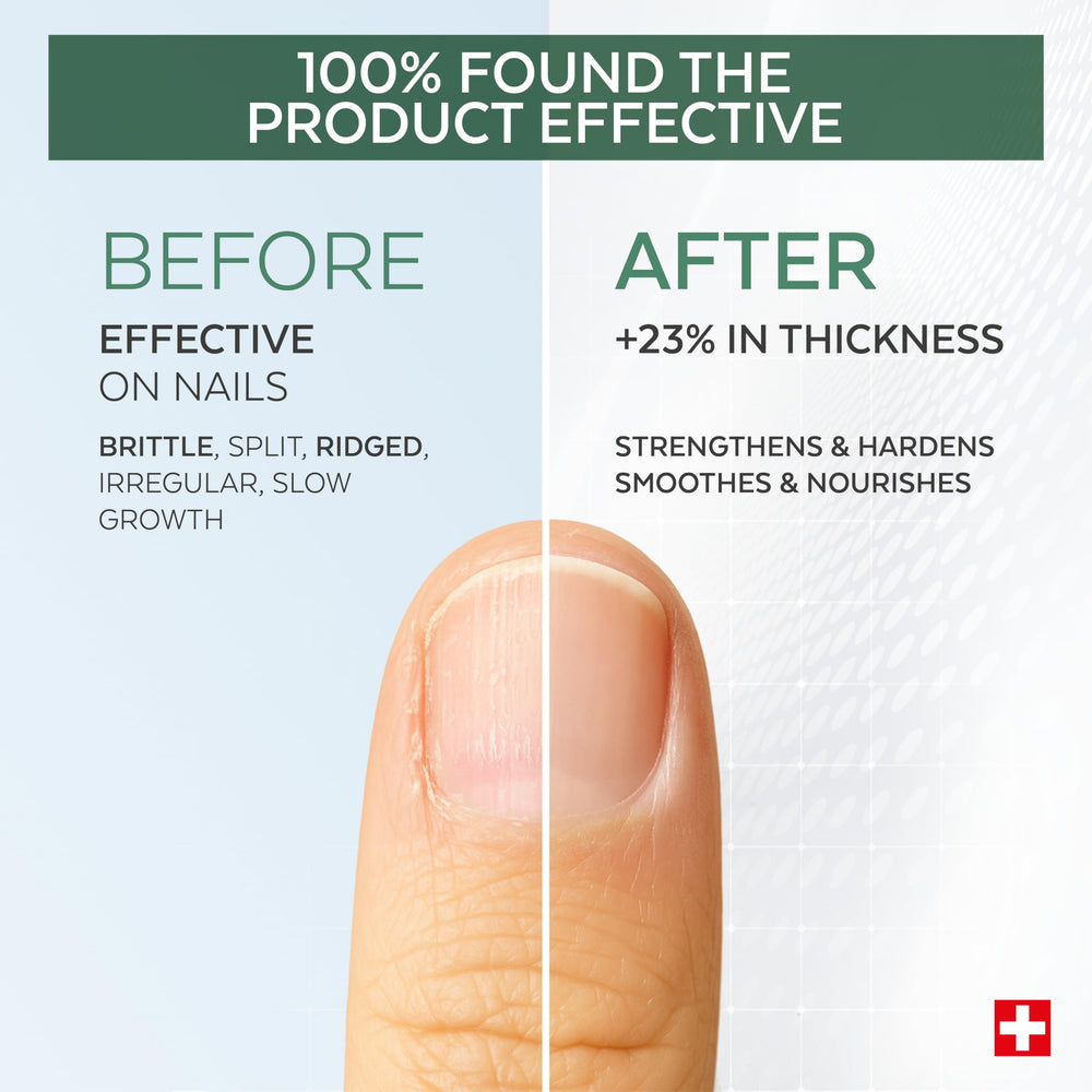 Poderm cuticle moisture-action showing softened, hydrated cuticles
