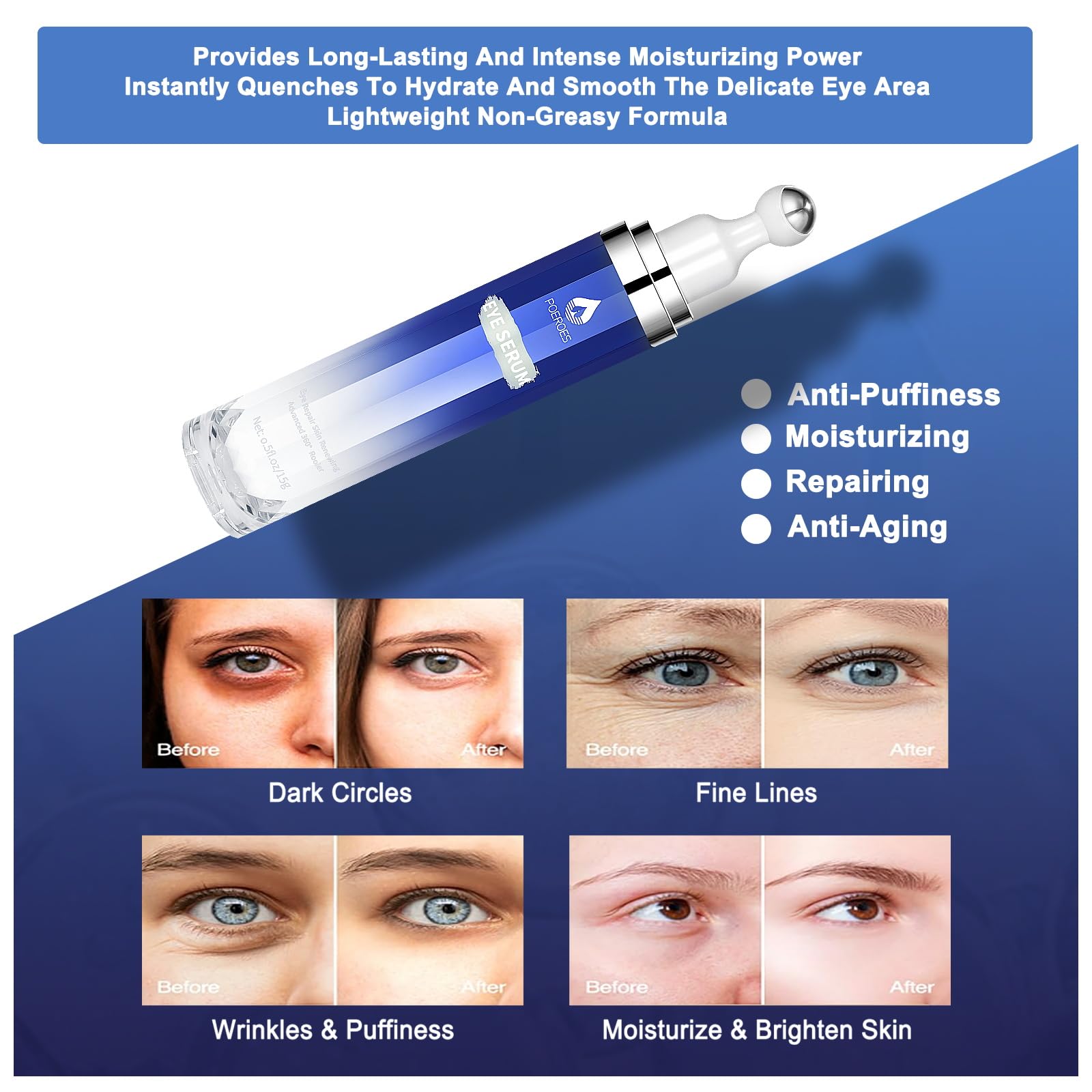 POEROES Eye Serum helps reduce dark circles and puffiness visually