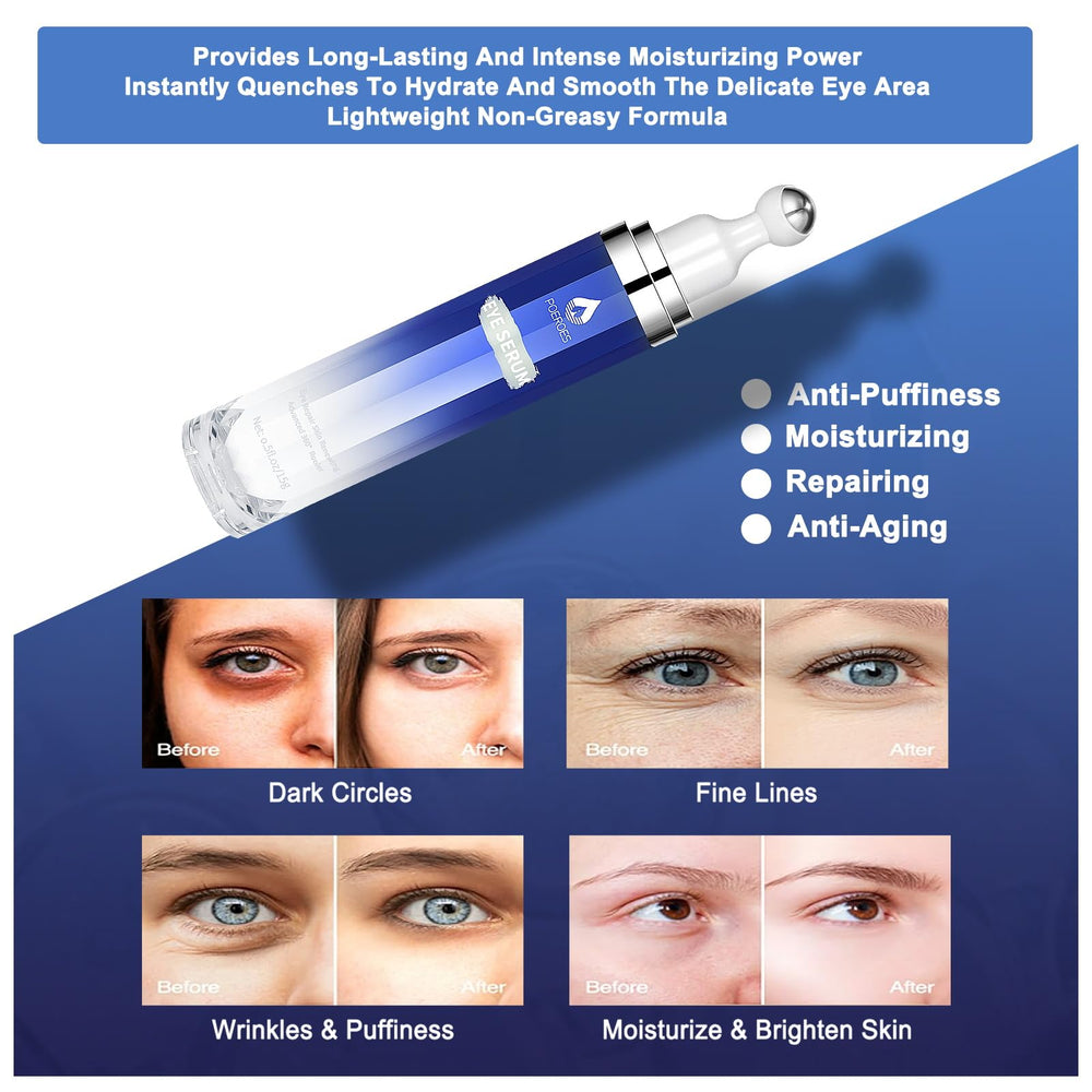 POEROES Eye Serum helps reduce dark circles and puffiness visually