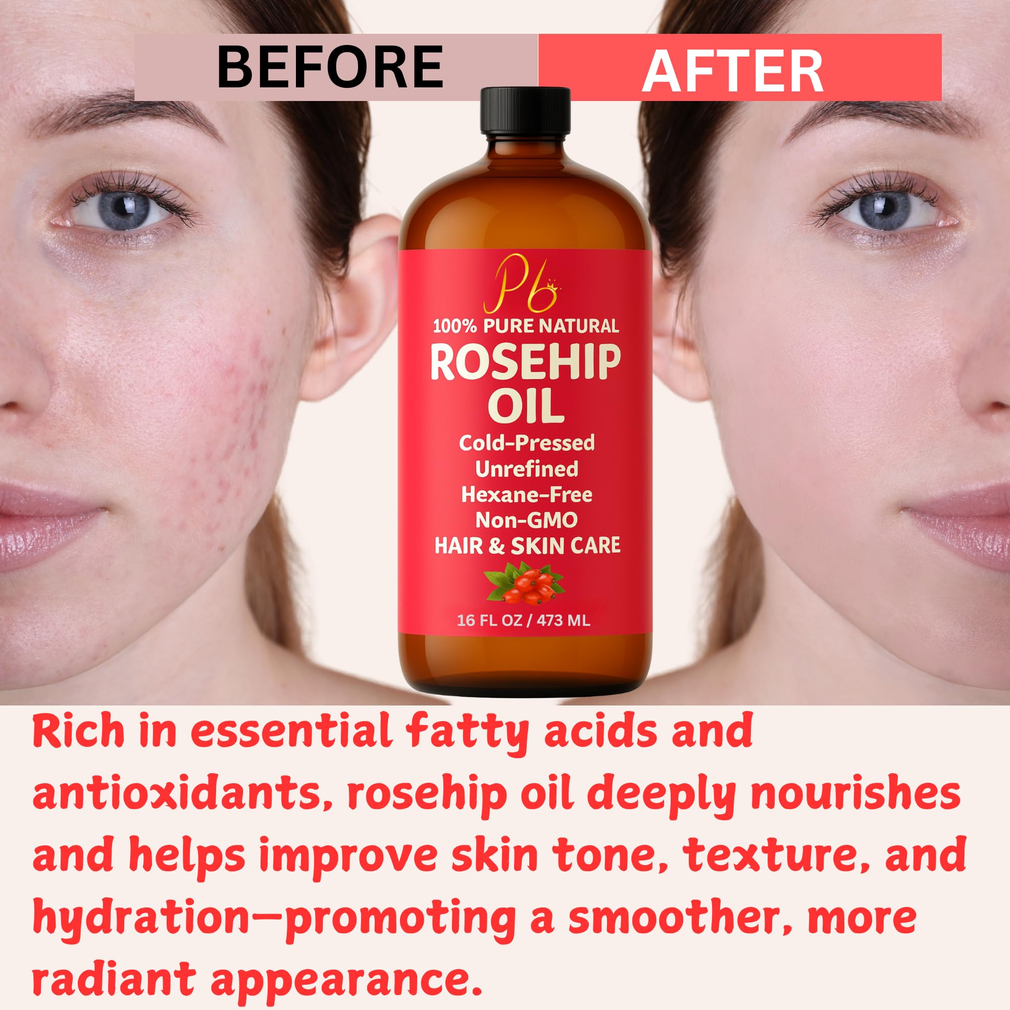 Pomberries Rosehip Seed Oil used as a body moisturizer to soften skin
