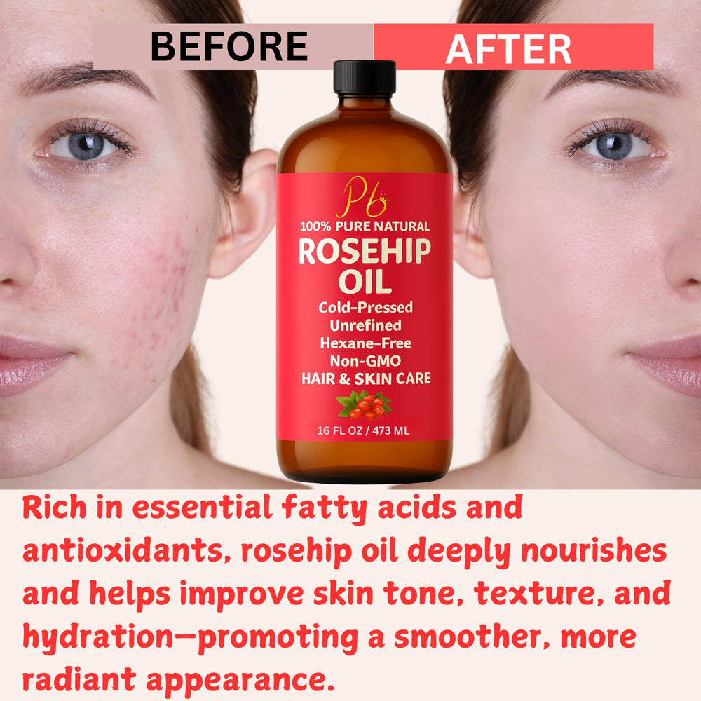 Pomberries Rosehip Seed Oil used as a body moisturizer to soften skin