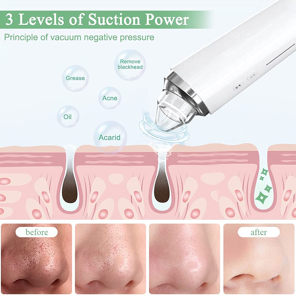 Prabensei replaceable probes drawer highlights six probes for tailored care