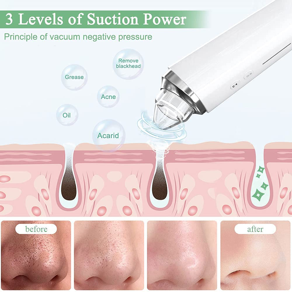 Prabensei replaceable probes drawer highlights six probes for tailored care