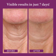 PRAI hyaluronic acid hydration close-up for plumped-looking skin.
