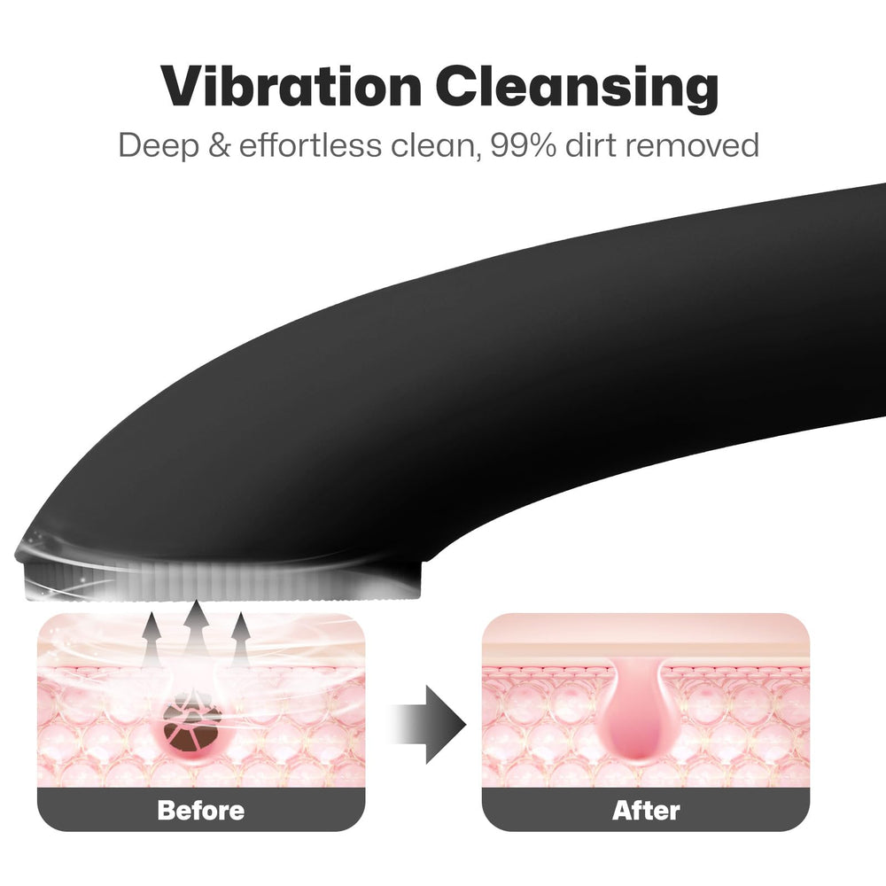 PRITECH silicone-bristles close-up highlighting gentle exfoliation for all skin types