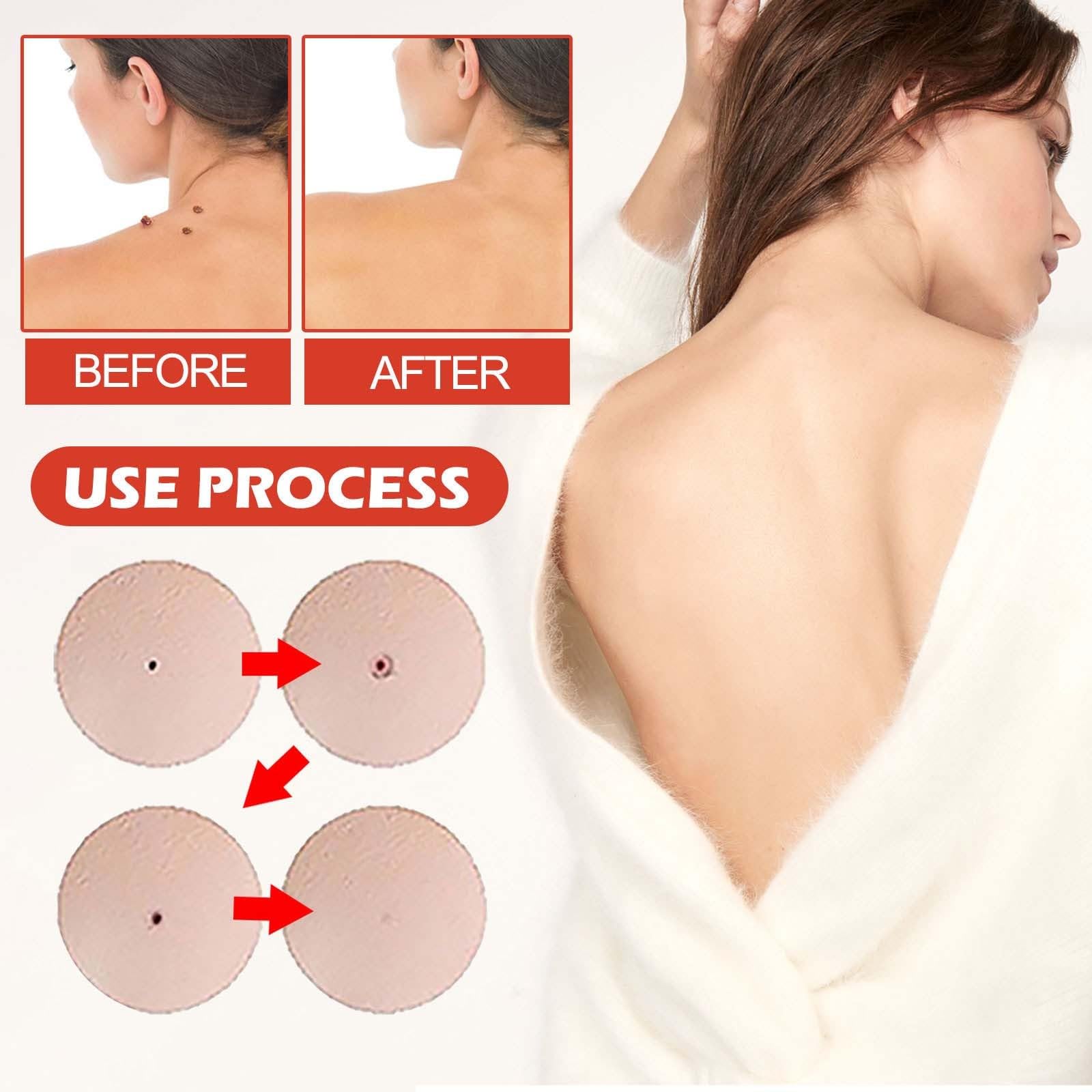 Pro Microdarts Patch used in a nightly skincare routine for blemish care.