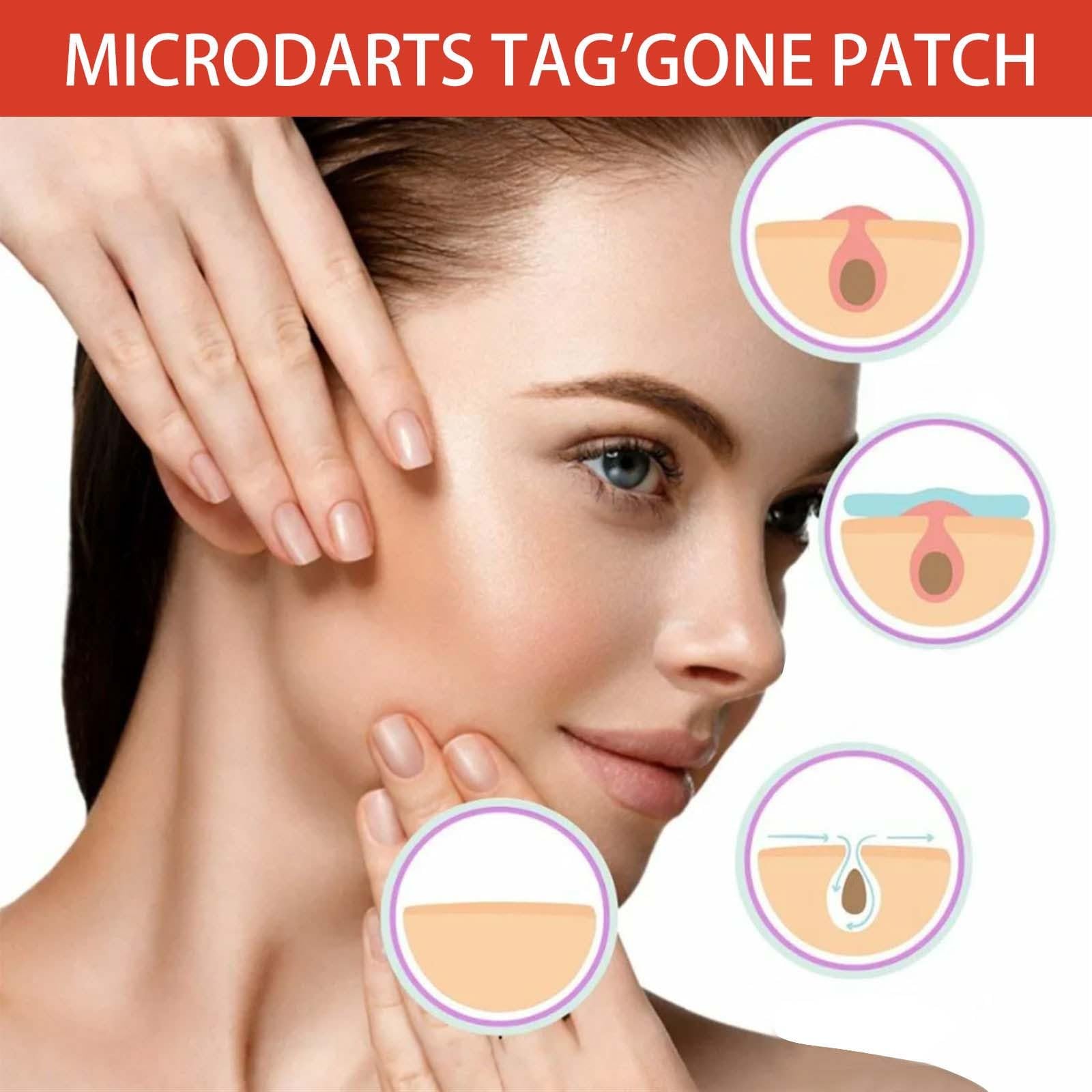 Pro Microdarts Patch on clean skin for night use.