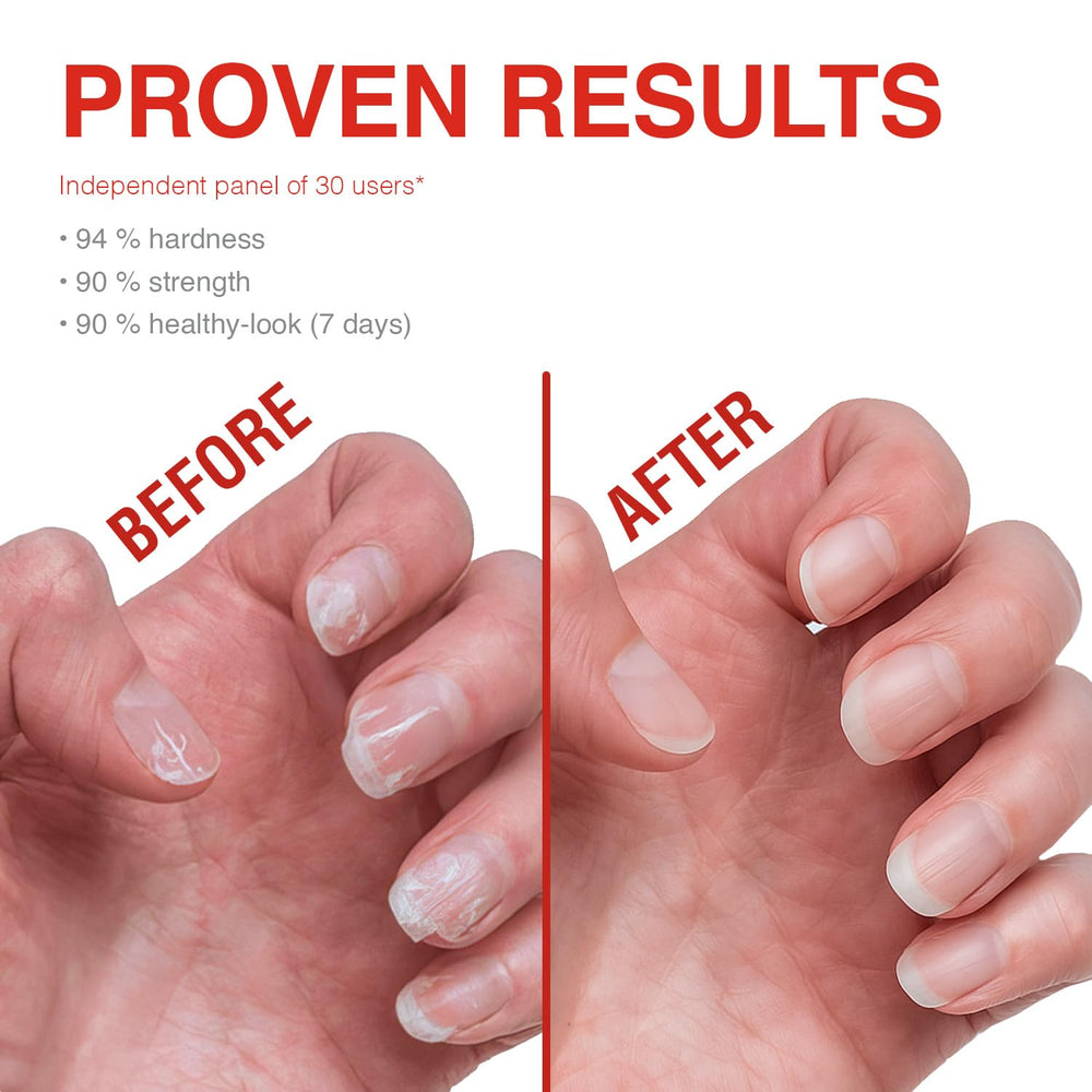 Hands applying Probelle Strengthener as daily treatment for nails