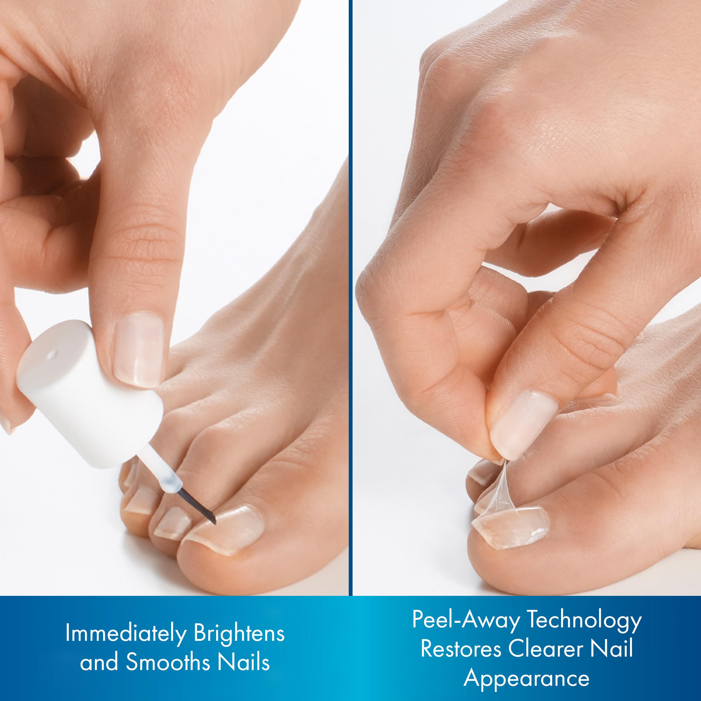 ProClearz Brite Now dries quickly and peels away keratin debris for cleaner look