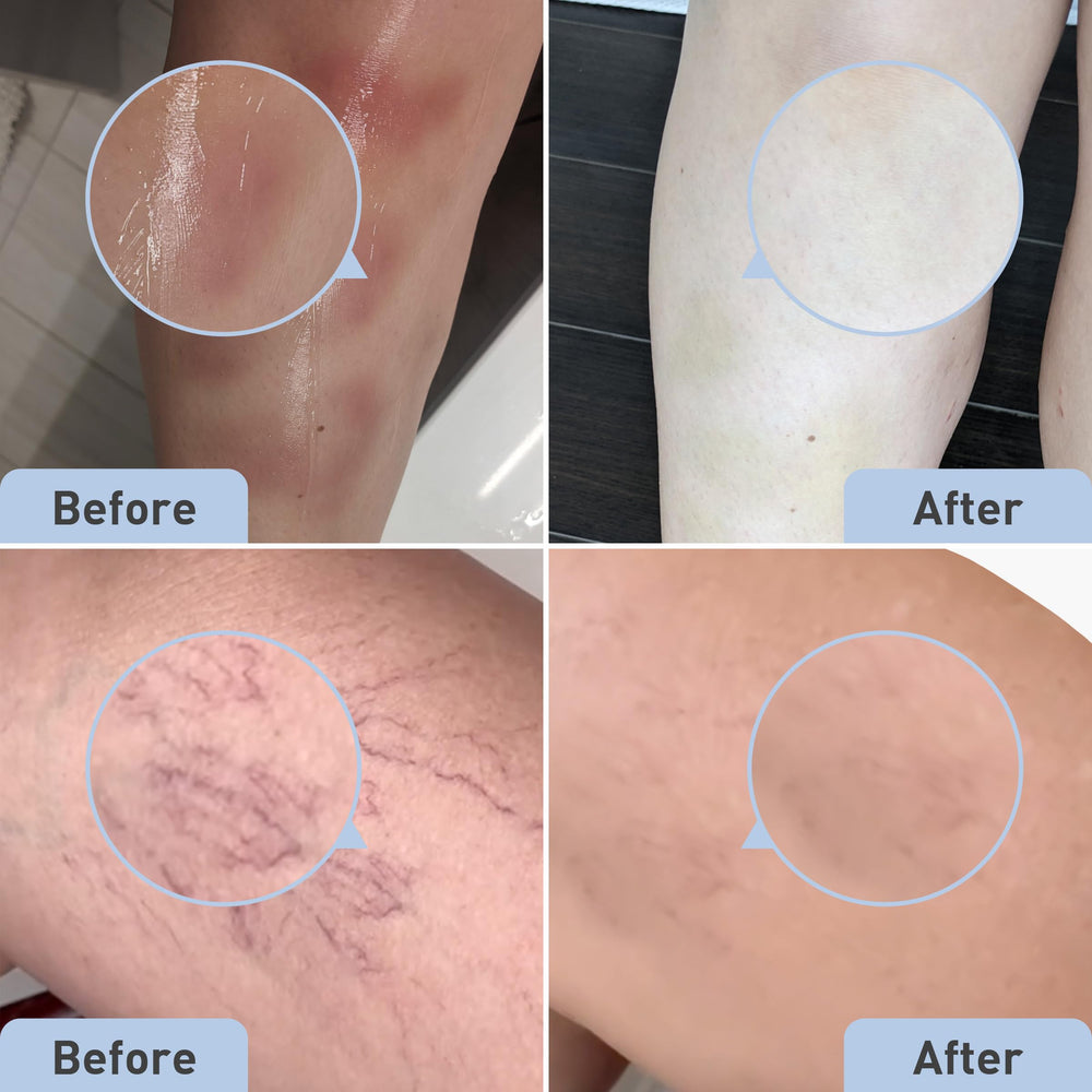 Coconut oil in PROcure Bruise Remedy Gel nourishes skin during use