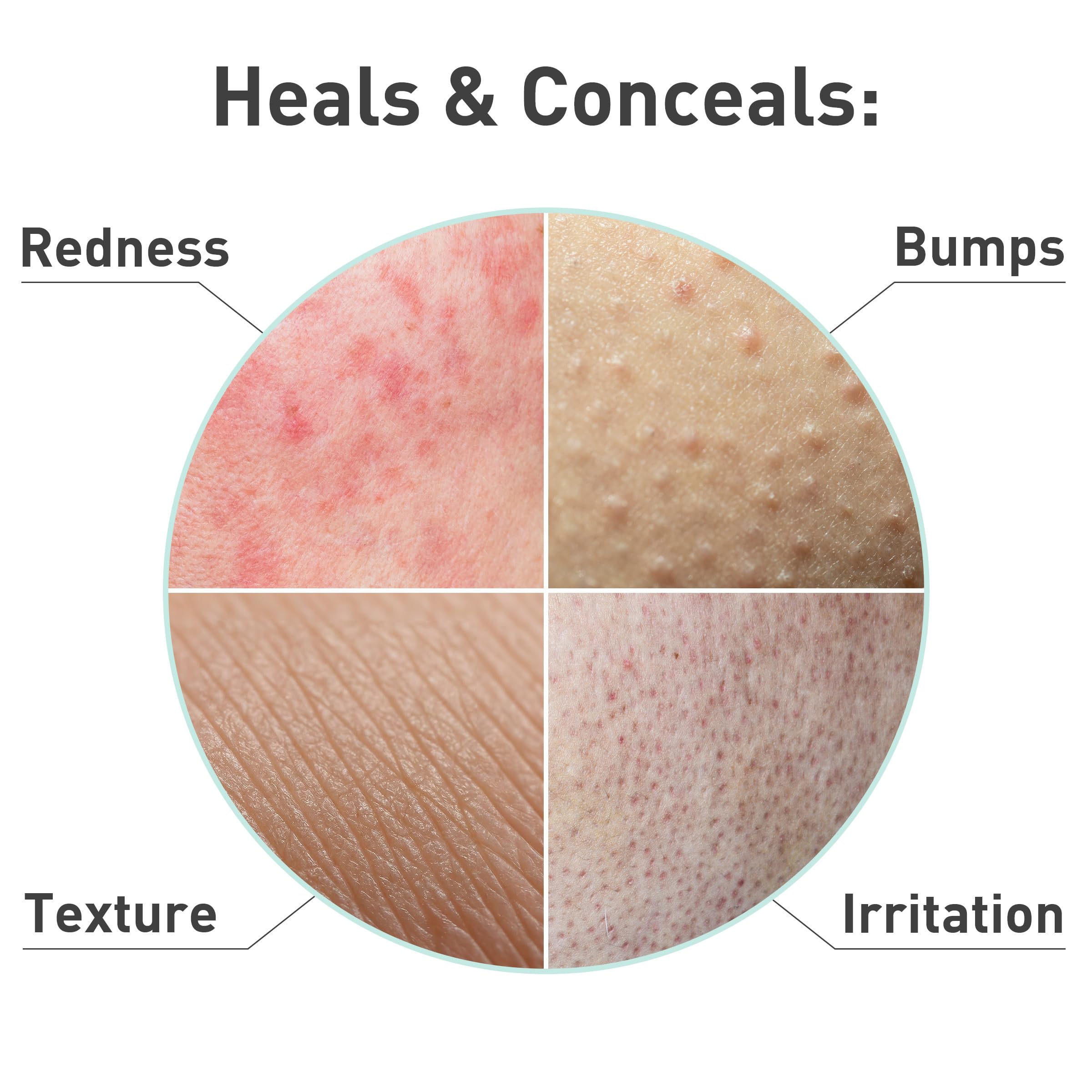 PROcure Rosacare Serum applied to face shows gentle hydration without heaviness