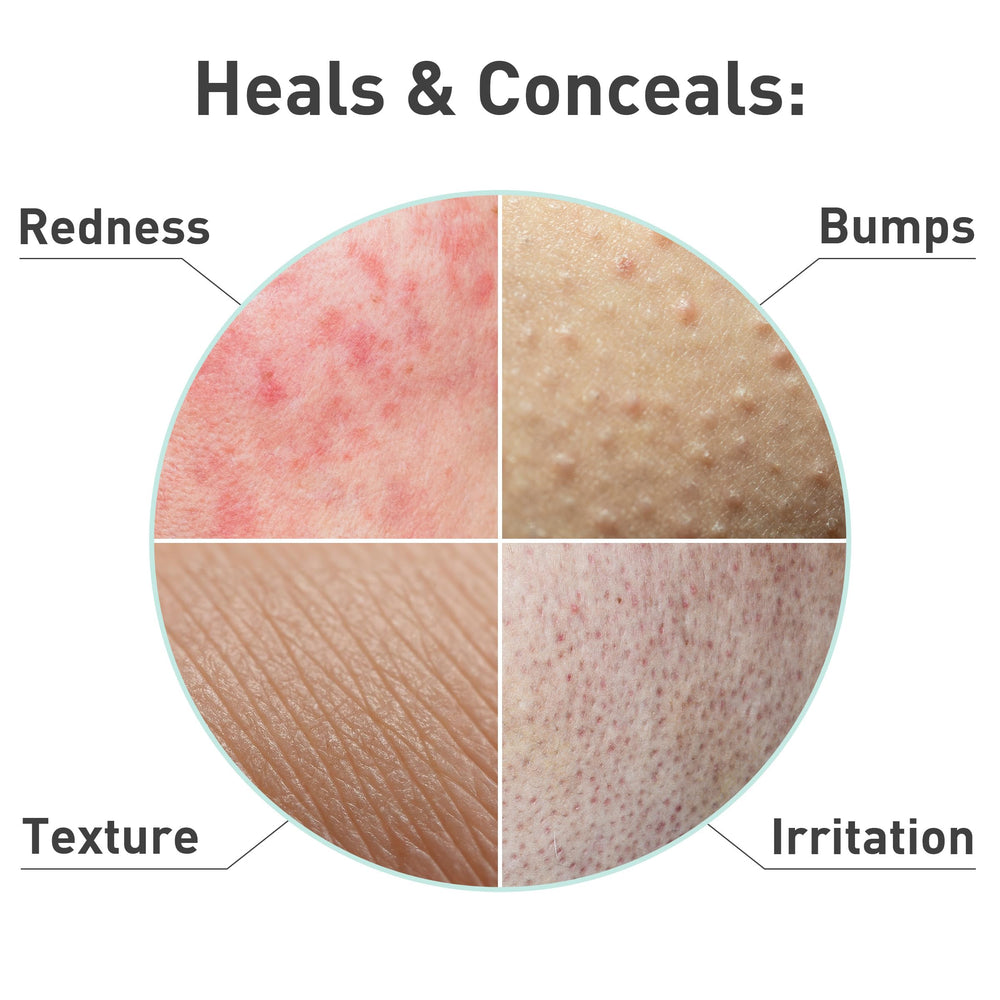 PROcure Rosacare Serum applied to face shows gentle hydration without heaviness