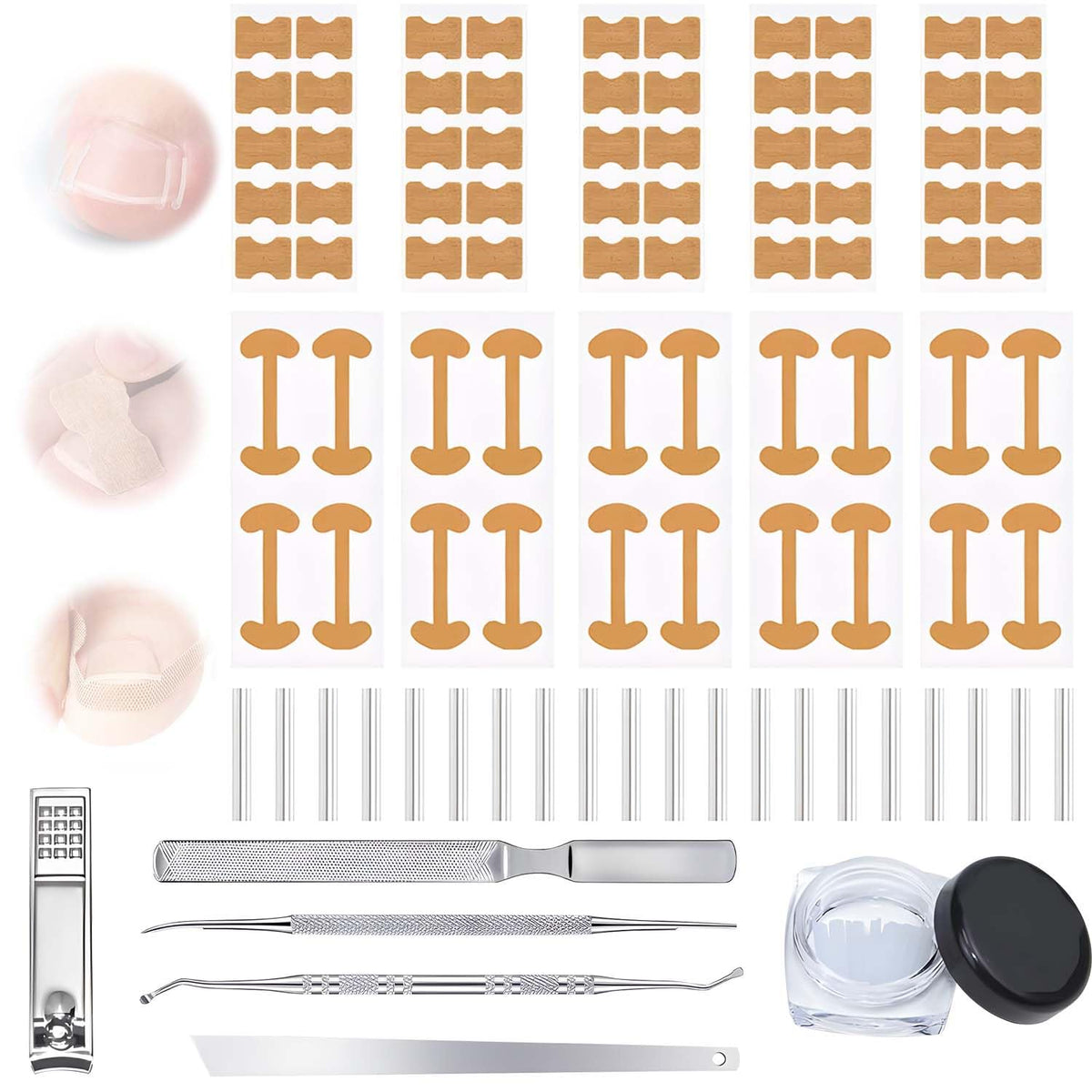 Professional Ingrown Toenail Corrector Kit patch closeup with breathable fabric for discreet wear.