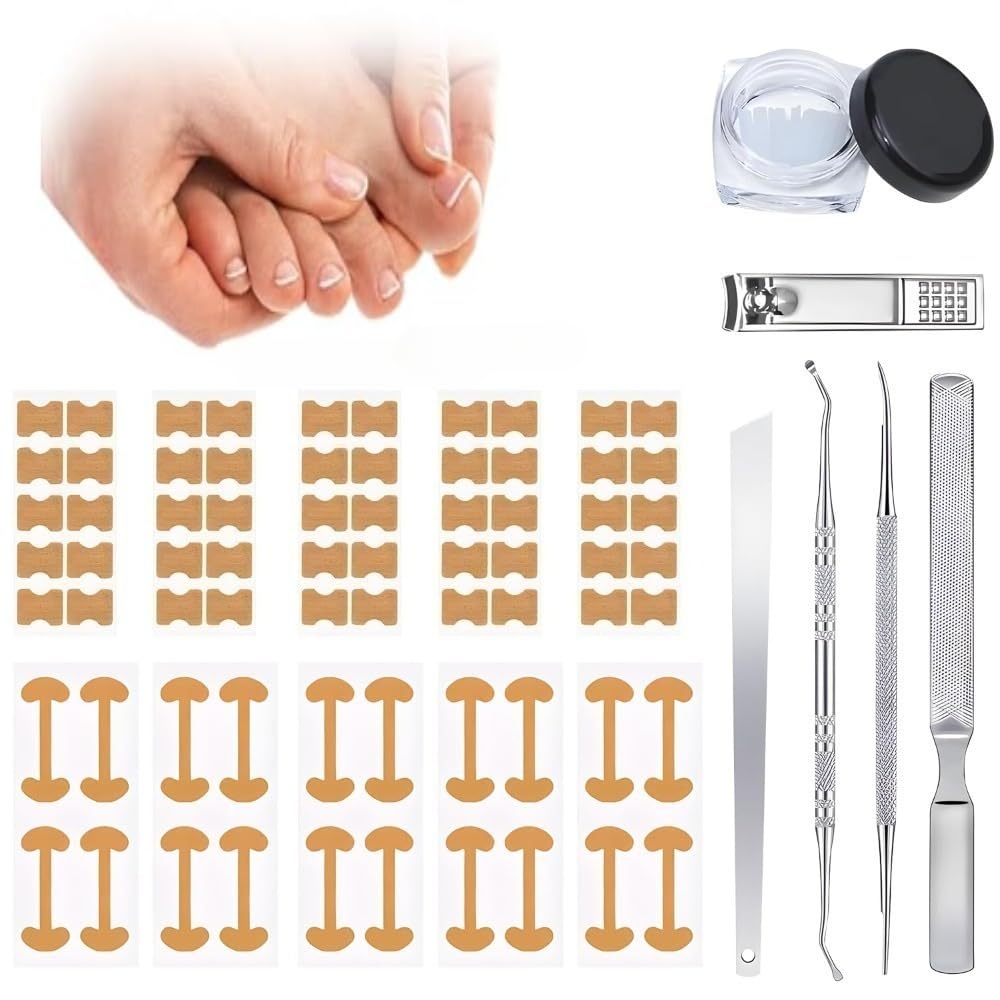 Professional Pedicure Tools ingrown toenail kit with breathable strips supports gentle at-home correction.