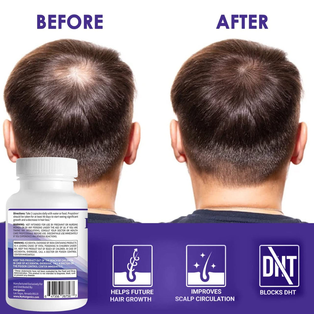 Pronexa Propidren alongside shampoo to illustrate a comprehensive hair care routine.