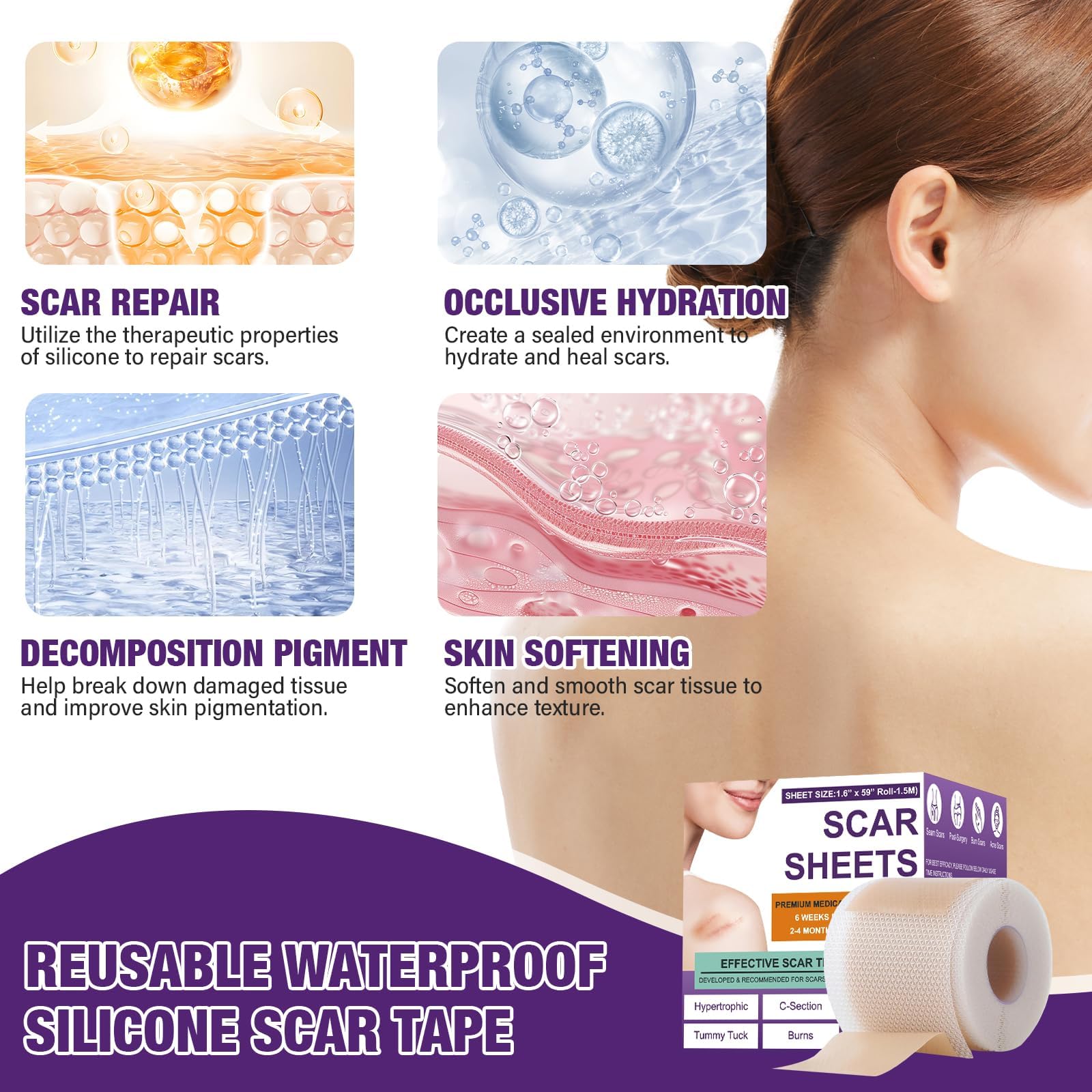 Psecici silicone scar sheets in 24-hour wear showing breathable design