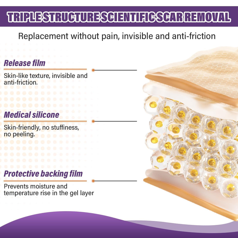 Psecici silicone scar sheets focused on keloid bump with potential removal support