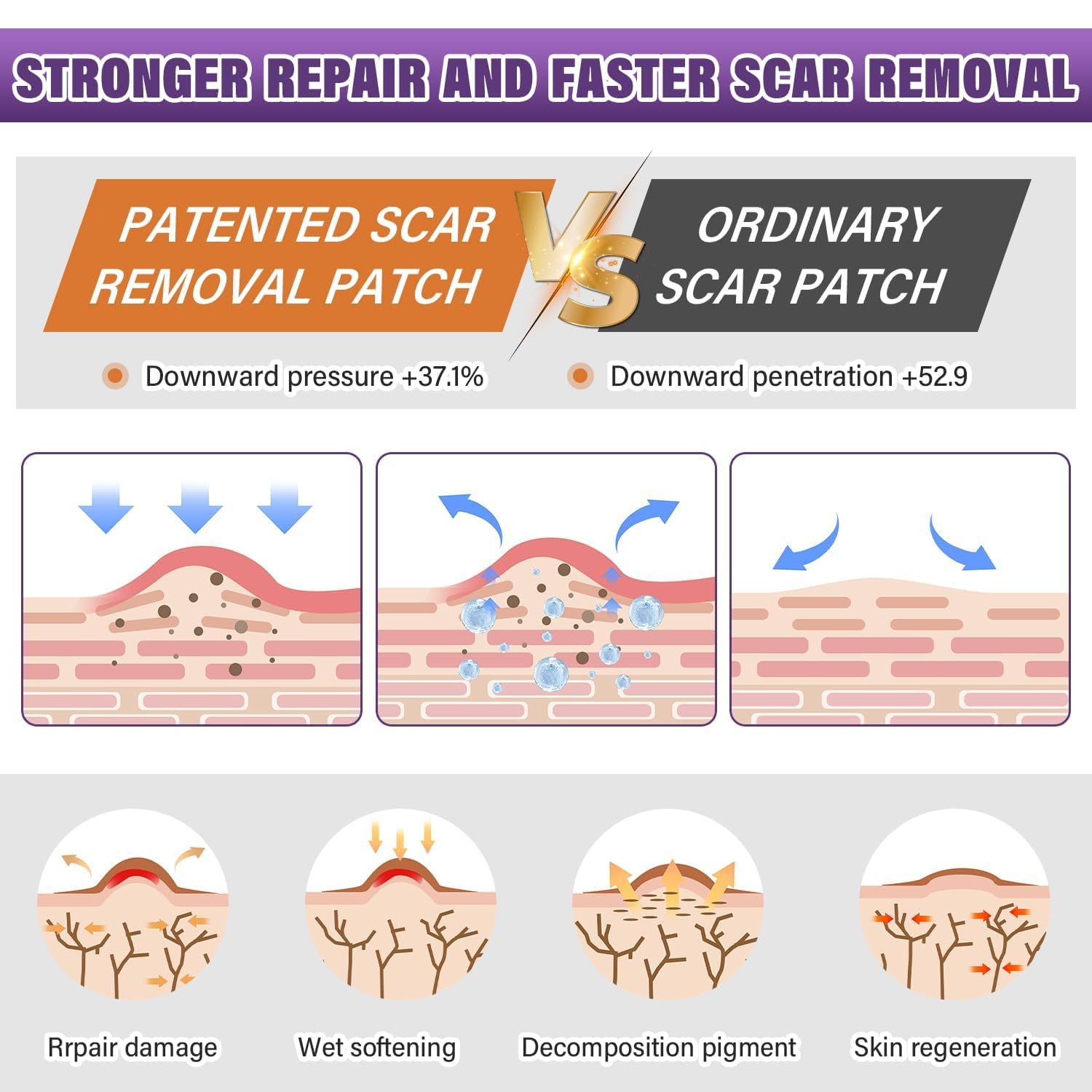 Psecici silicone scar sheets applied to a surgical scar demonstration