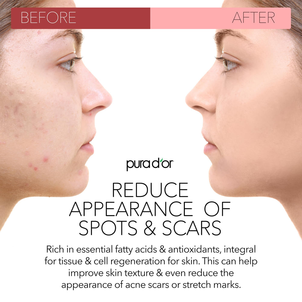 PURA D OR Rosehip Seed Oil ingredients closeup highlighting vitamins A and C