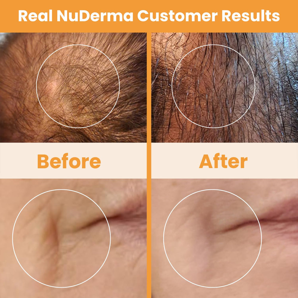 Pure Daily Care NuDerma support manual emphasizes safe usage and results guidance