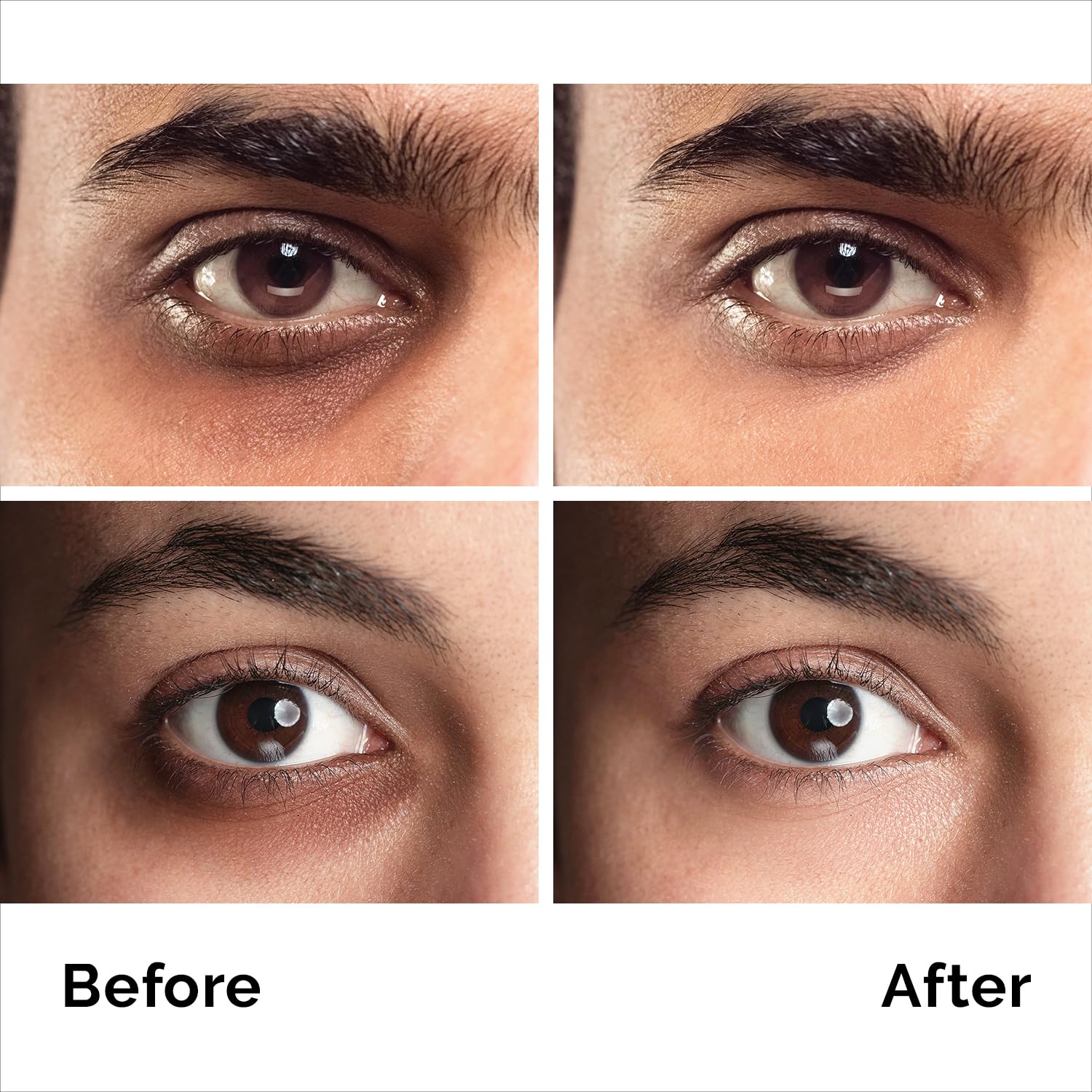 Pure Research caffeine eye cream application demonstrates lightweight texture for smoothing puffiness.