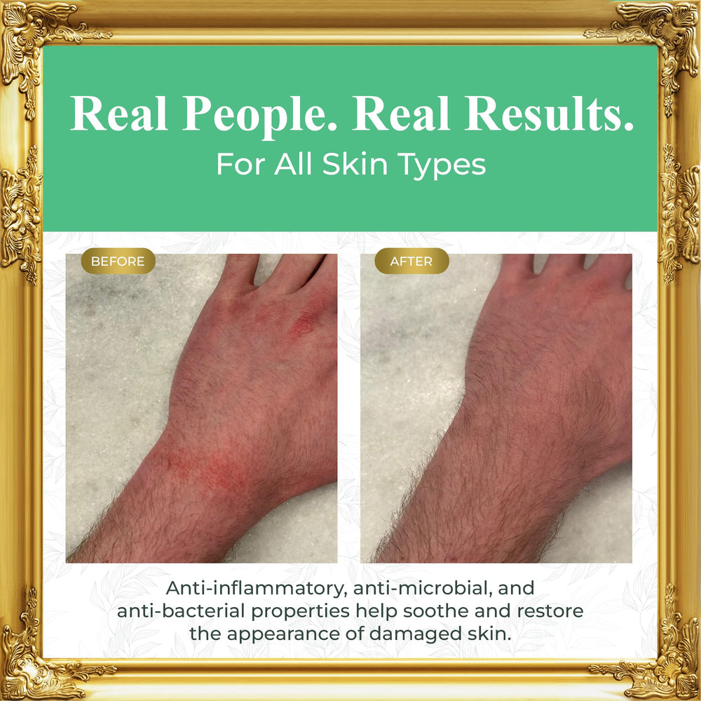 Pure Truth lip, hands, and feet use showing versatile moisturization