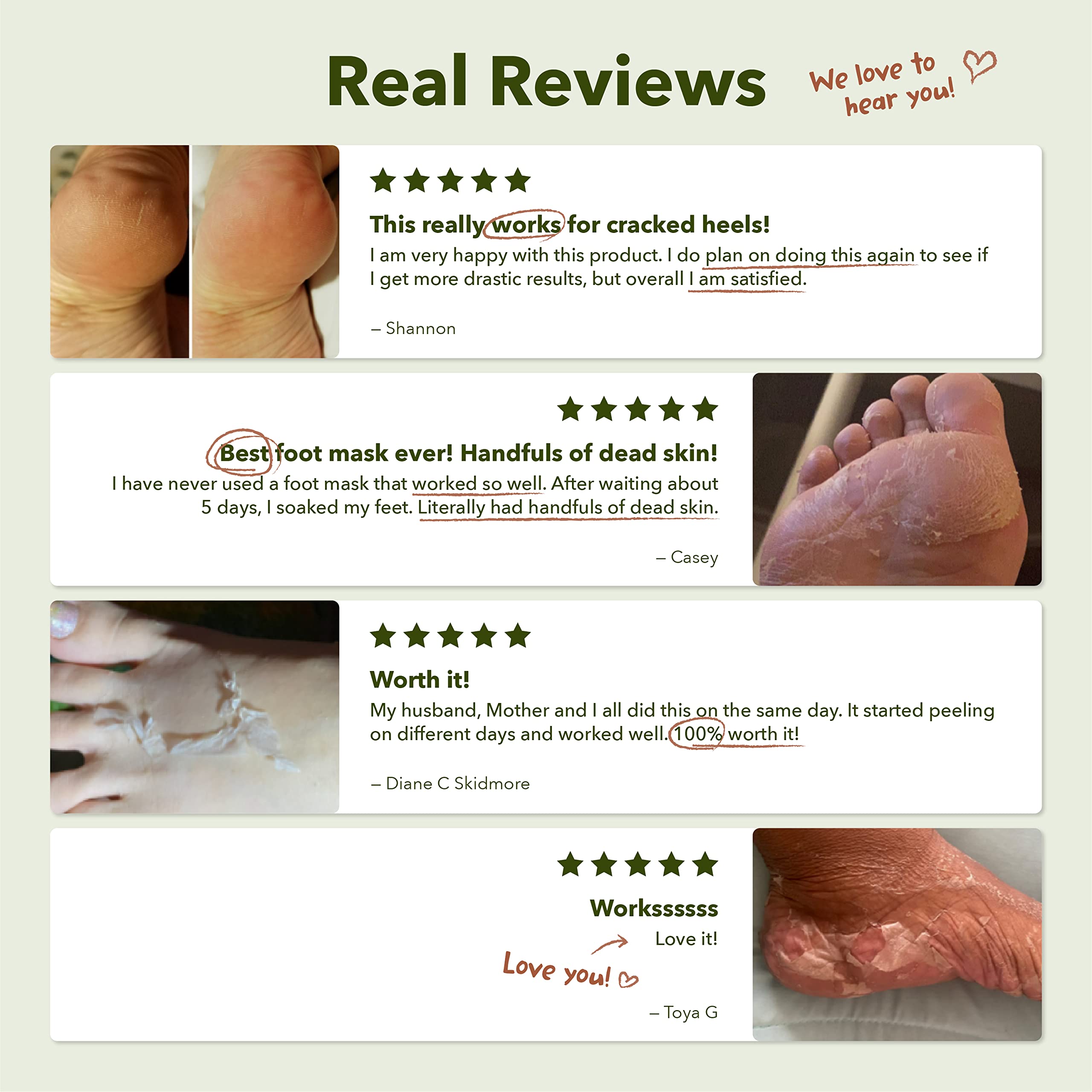 Purederm Shiny & Soft Foot Peeling Mask demonstrates universal fit for men and women.
