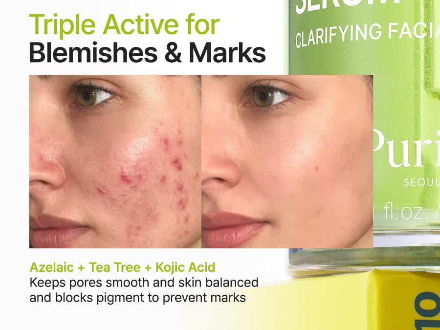 PURITO Azelaic Serum dropper enables precise application for breakouts