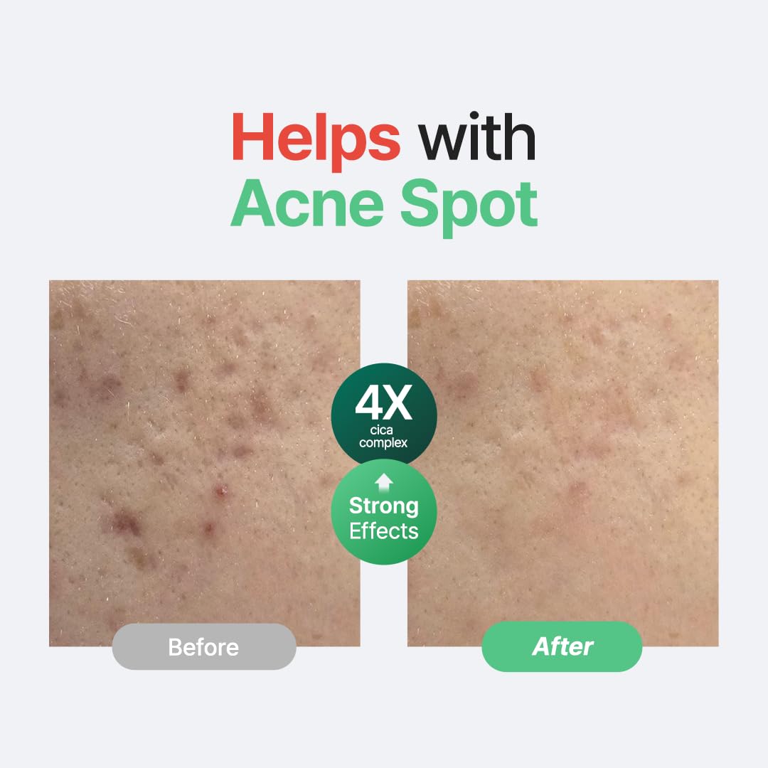 PURITO Centella Unscented Serum dropper dispensing clear gel for fast calming effects.