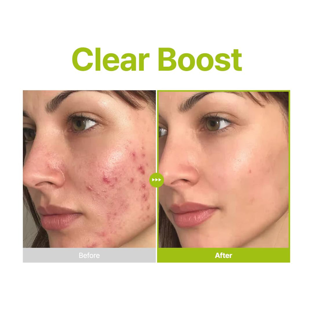 PURITO Azelaic Serum texture close-up lightweight non-greasy finish