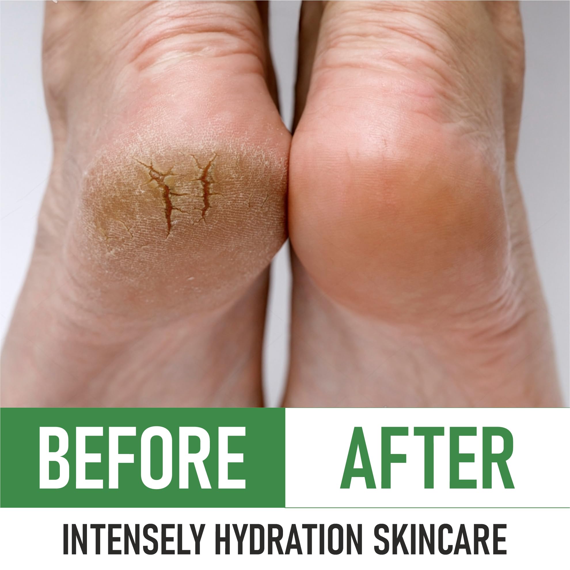 PurOrganica Urea 40% Foot Cream with dermatologist-tested badge.