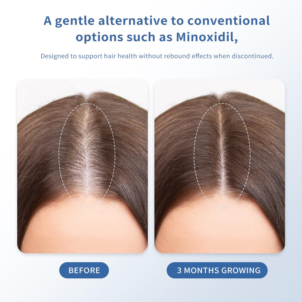 QGGQ Hair Growth Serum Roll-On roller-tip enables targeted application.