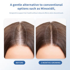 QGGQ Hair Growth Serum Roll-On roller-tip enables targeted application.