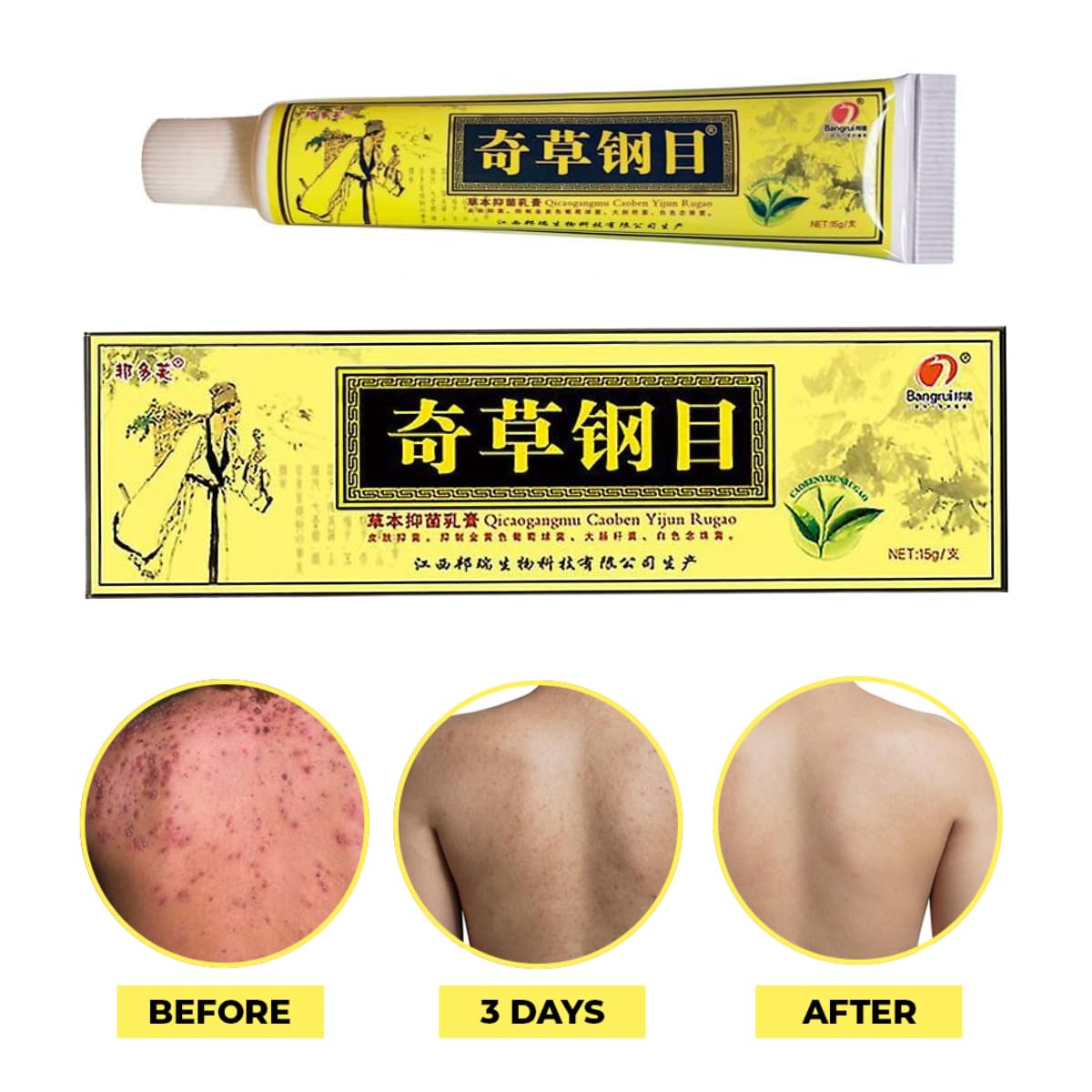 QICAOGANGMU Chinese Herbal Cream being applied to dry skin for relief