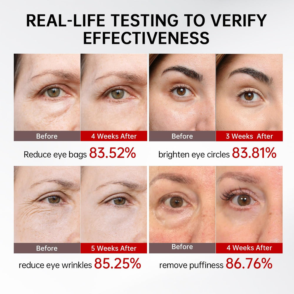 QQE Eye Serum under-eye application demonstrates precise dosing and gentle roll-on for easy use.