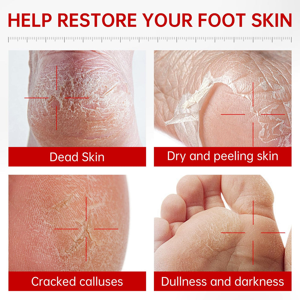 QQE Foot Peeling Mask three-pack box illustrating value-packed kit for dry feet.