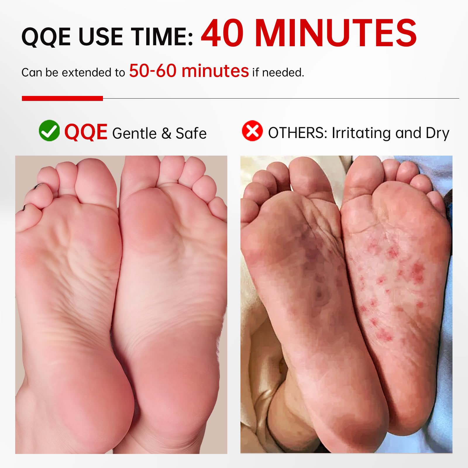 QQE Foot Peeling Mask before and after usage shows visible improvement.