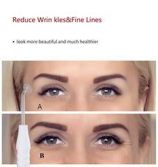 Quiet&Far high-frequency wand uses interchangeable electrodes for precise care.