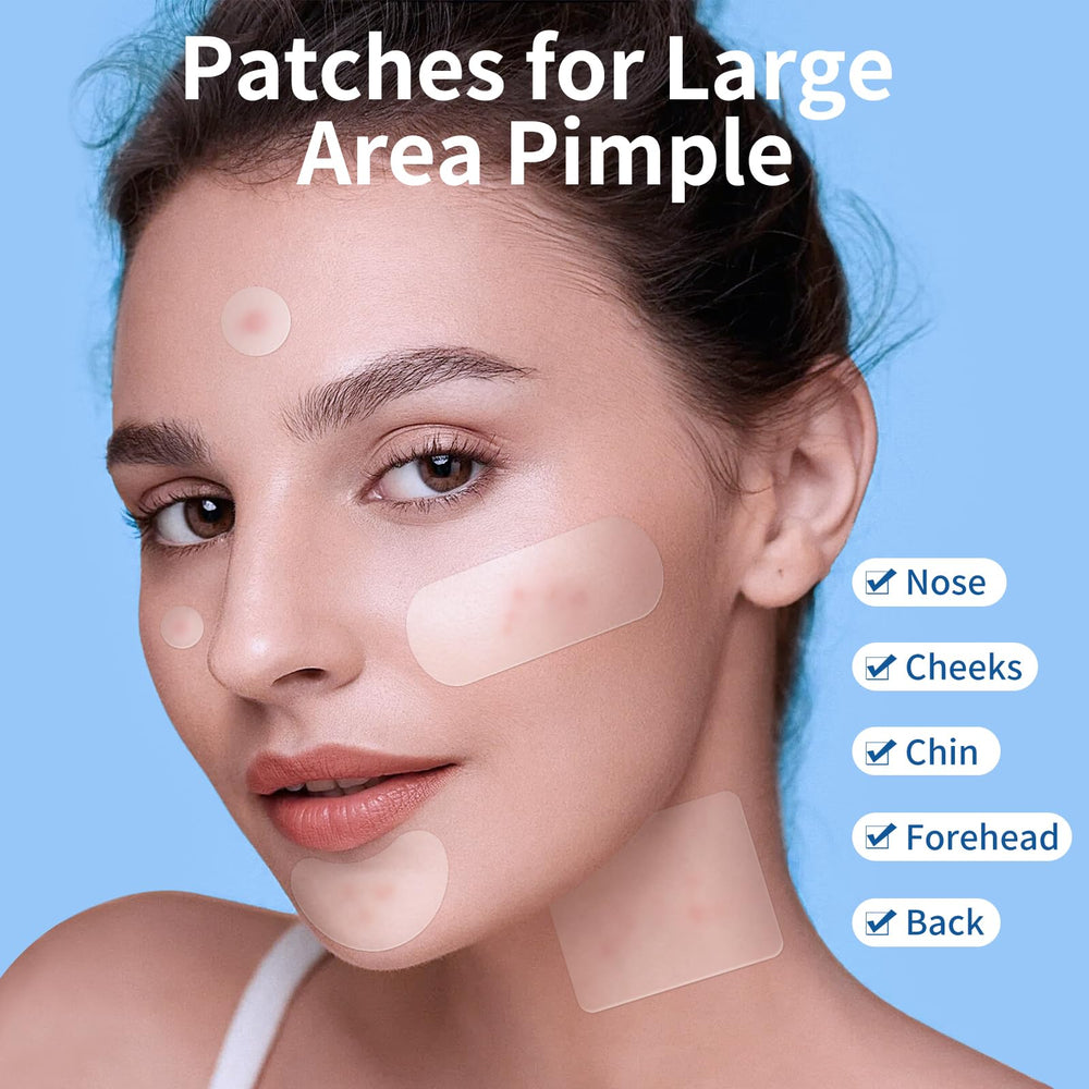 QUSTERE large patches designed for chest or back breakouts overnight