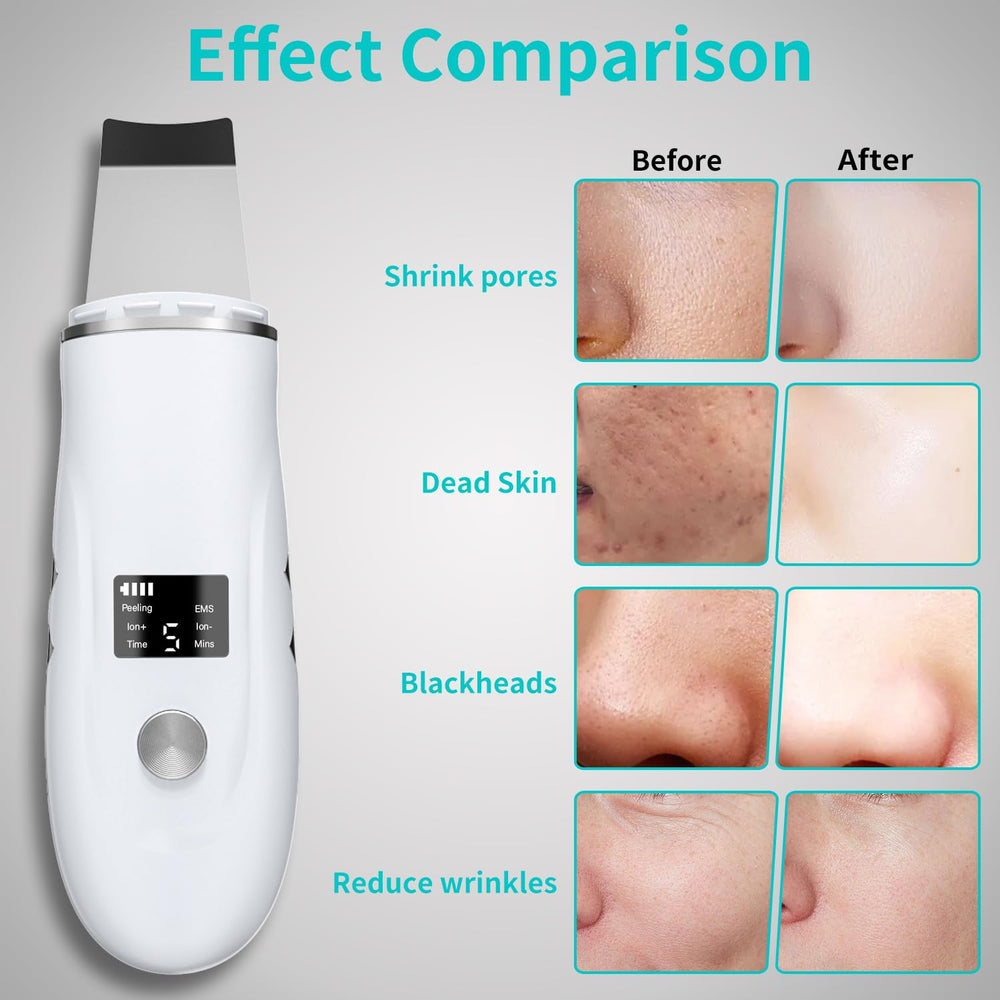 QYCSL Face Scrubber features a 3D curved design for smooth maneuvering