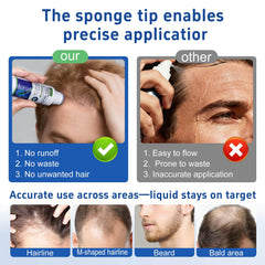 QYFJ minoxidil serum bottle back label with usage directions.