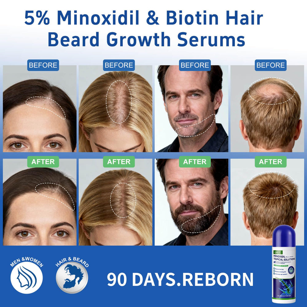 QYFJ minoxidil serum bottle front view for consistent use.