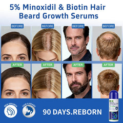 QYFJ minoxidil serum bottle front view for consistent use.