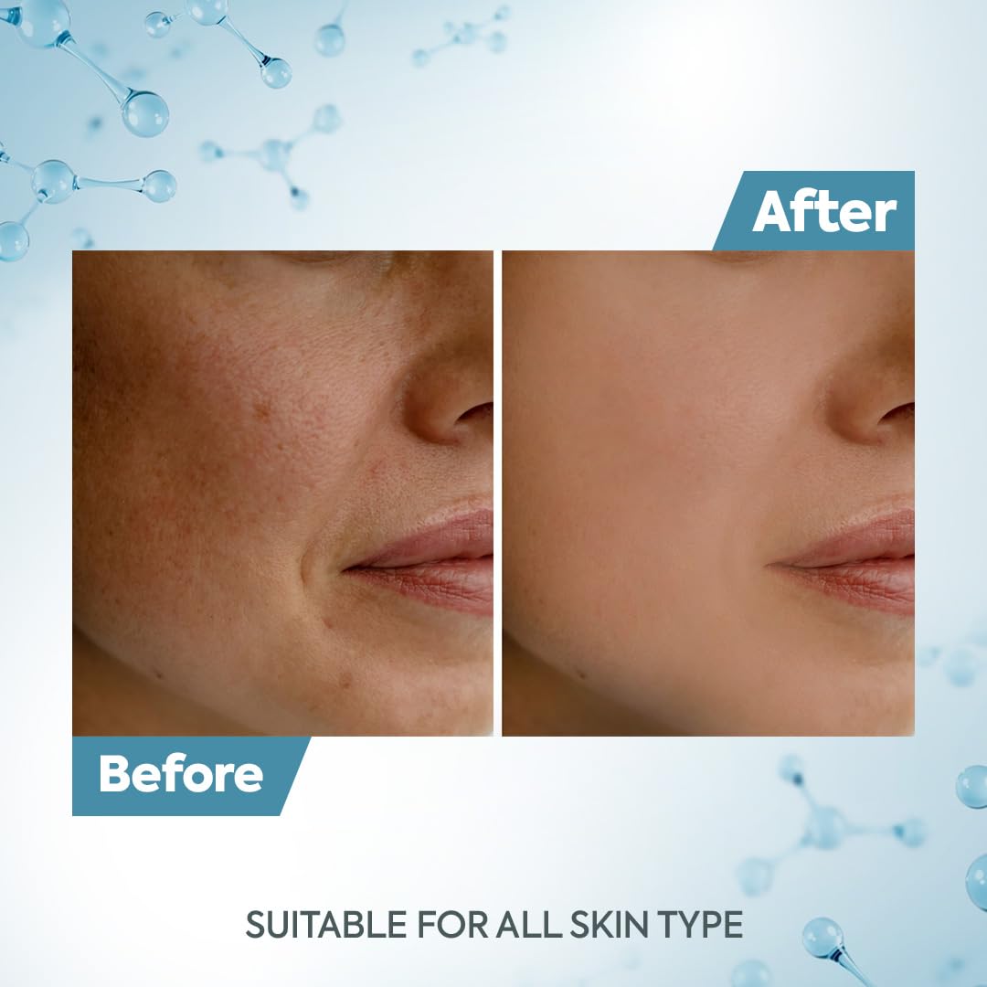 Raaga Professional De-Tan Cream arbutin closeup suggests more even skin tone